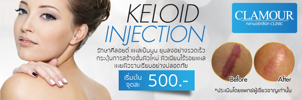 Keloid Injection